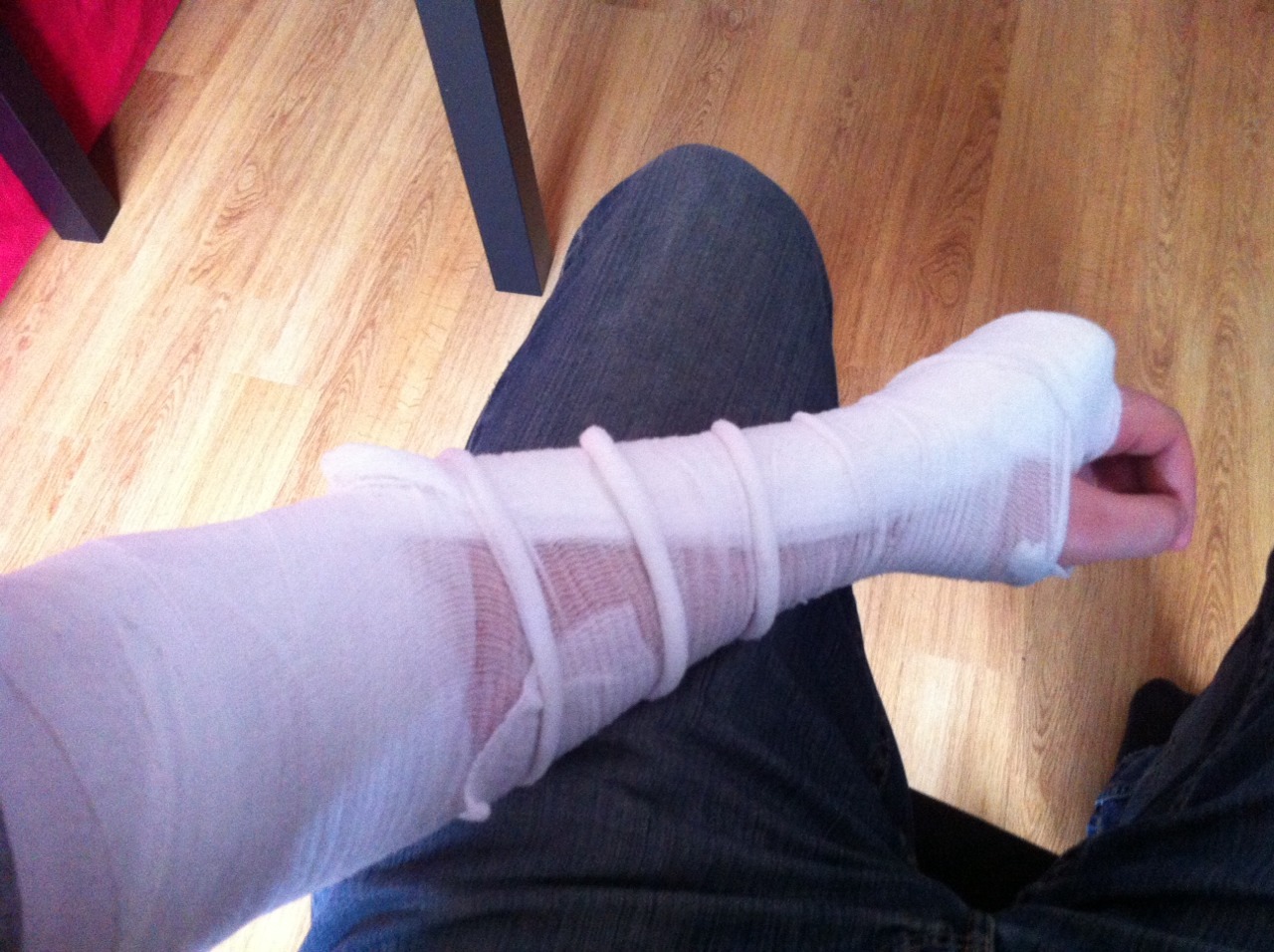 I broke my arm last Sunday afternoon. It was a &ndash; I believe &ndash; pretty unspectacular bike accident. But I fell really unfortunate and now I have a semi-complicated fracture right above the elbow joint.
I&rsquo;m going to have surgery tomorrow (Wednesday) and...